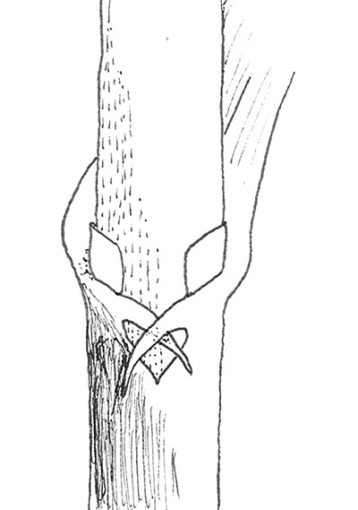 Clasping auricles